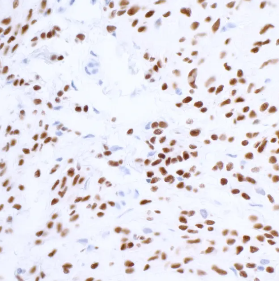 Rabbit SOX10 Recombinant Monoclonal Antibody