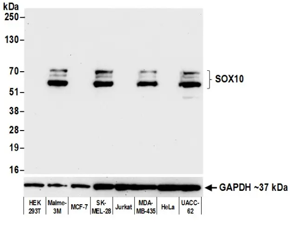 Rabbit SOX10 Recombinant Monoclonal Antibody