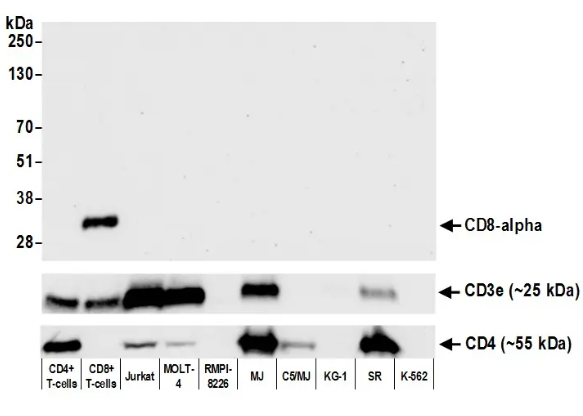 Rabbit anti-CD8 alpha Recombinant Monoclonal Antibody
