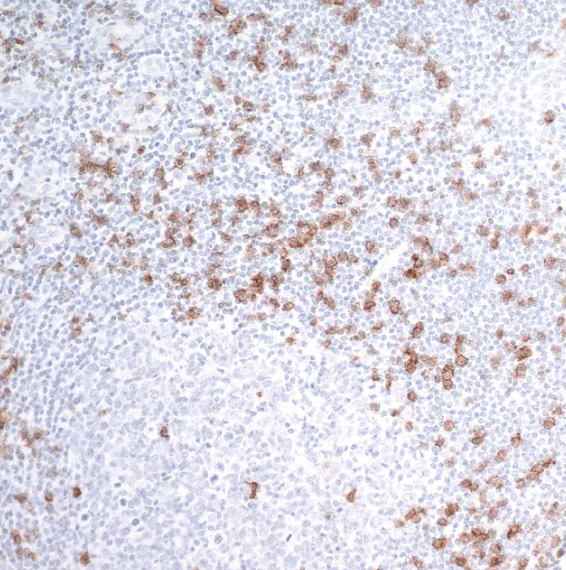 Rabbit anti-CD8 alpha Recombinant Monoclonal Antibody