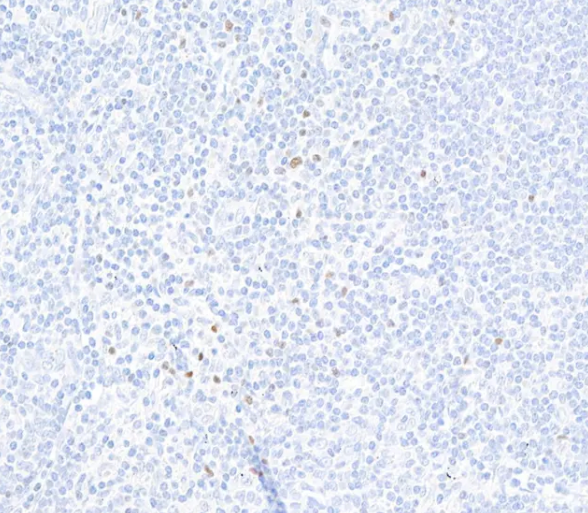 Rabbit FOXP3 Recombinant Monoclonal Antibody