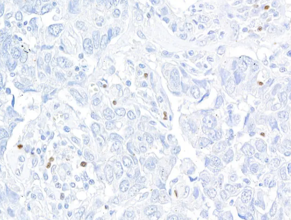 Rabbit FOXP3 Recombinant Monoclonal Antibody
