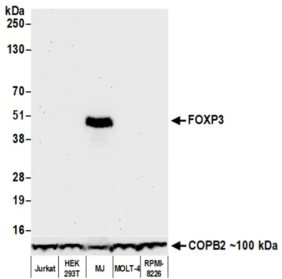 Rabbit FOXP3 Recombinant Monoclonal Antibody