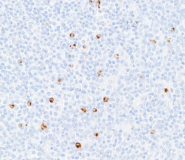 Rabbit LAG3 Recombinant Monoclonal Antibody