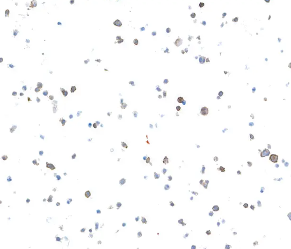 Rabbit LAG3 Recombinant Monoclonal Antibody