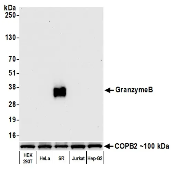 Granzyme B Antibody