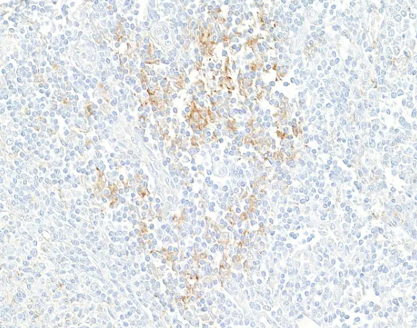 Rabbit PD-L1 Recombinant Monoclonal Antibody