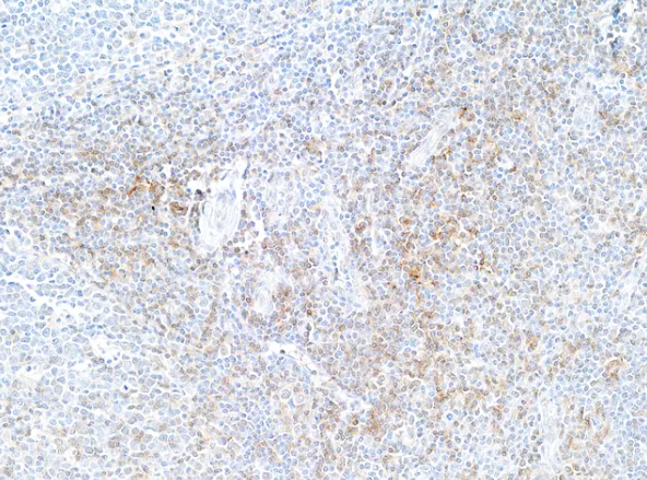 Rabbit anti-CD4 Recombinant Monoclonal Antibody
