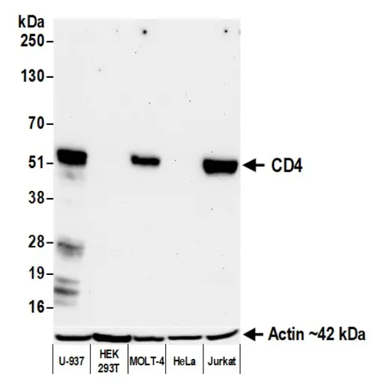 Rabbit anti-CD4 Recombinant Monoclonal Antibody