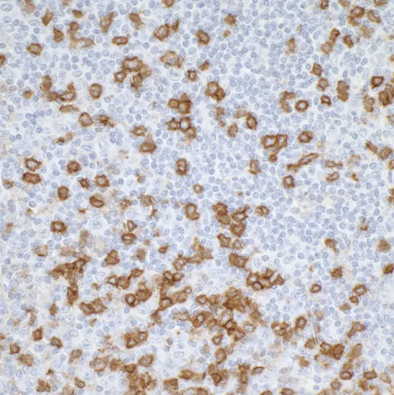 Mouse anti-CD45RO Monoclonal Antibody