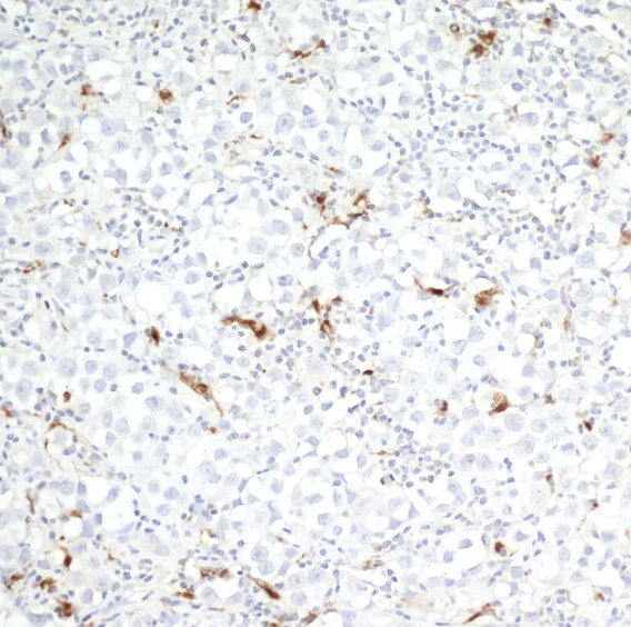 Mouse anti-CD68 Recombinant Monoclonal Antibody