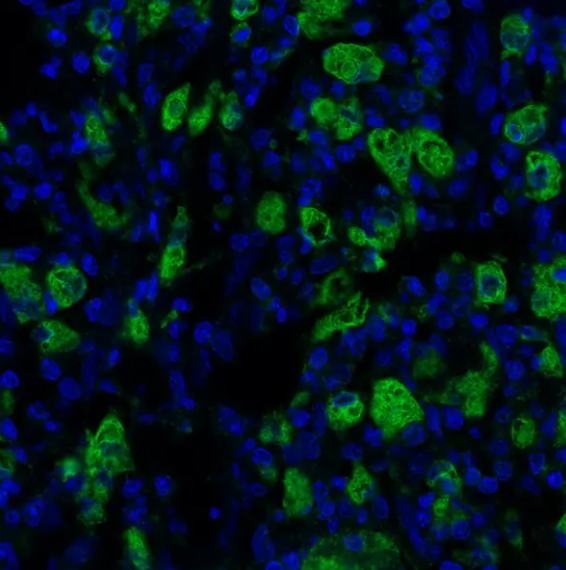 Mouse anti-CD68 Recombinant Monoclonal Antibody