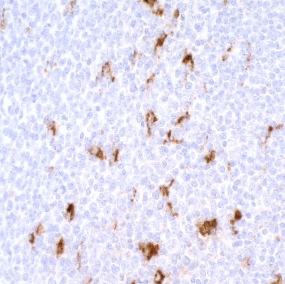 Mouse anti-CD68 Recombinant Monoclonal Antibody