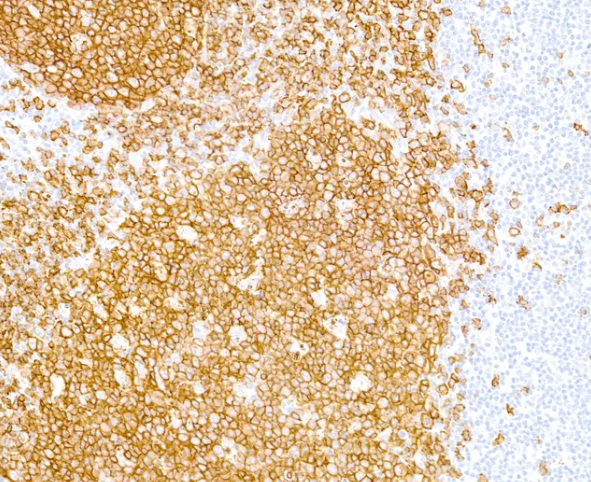 CD20 Mouse Monoclonal Antibody