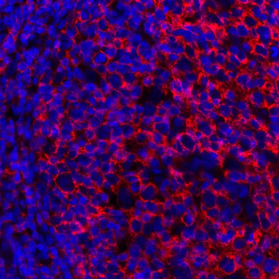 CD20 Mouse Monoclonal Antibody