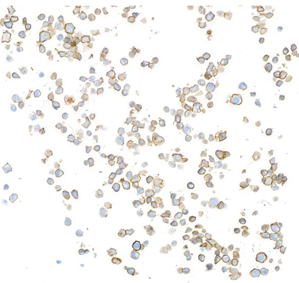 CD20 Mouse Monoclonal Antibody