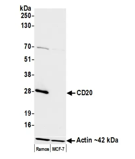 CD20 Mouse Monoclonal Antibody