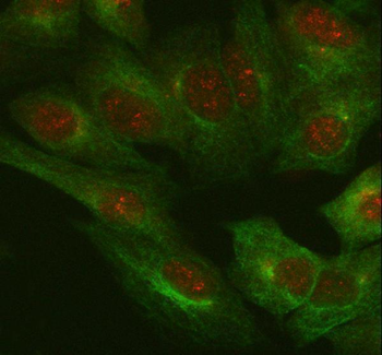 IL18 Rabbit Polyclonal Antibody
