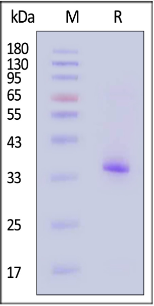 Human FGF-5 Protein, His Tag