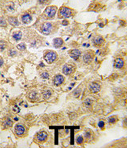 NANOS2 Antibody (C-term)