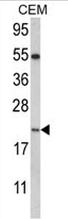 NANOS2 Antibody (C-term)