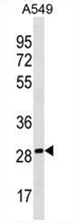 PEBP4 Rabbit Polyclonal Antibody