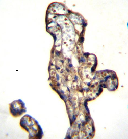 SLC15A3 Antibody (Center)