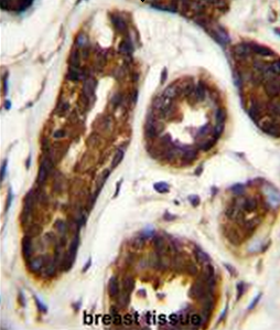 Maspin Antibody (Center)