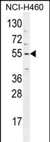 TRIM65 Antibody (Center)
