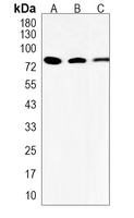 AKAP5 Rabbit Polyclonal Antibody