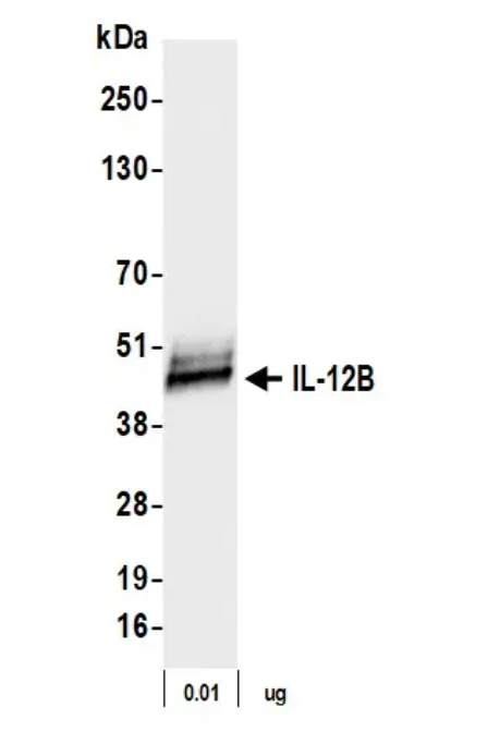Rabbit IL-12B Recombinant Monoclonal Antibody