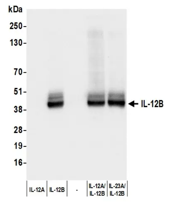 Rabbit IL-12B Recombinant Monoclonal Antibody