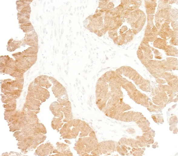 Rabbit p16INK4a Recombinant Monoclonal Antibody