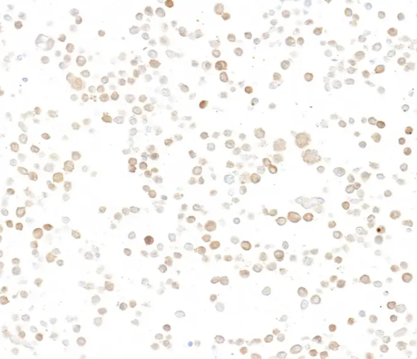 Rabbit p16INK4a Recombinant Monoclonal Antibody