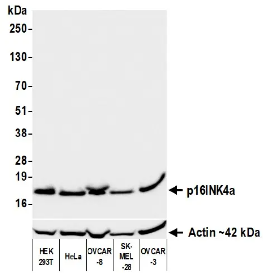 Rabbit p16INK4a Recombinant Monoclonal Antibody