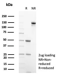 IgG2a Isotype Control for Mouse Antibody
