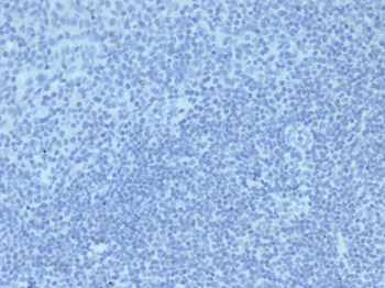 IgG2a Isotype Control for Mouse Antibody