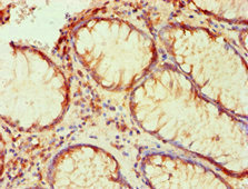 PLA2G7 Antibody