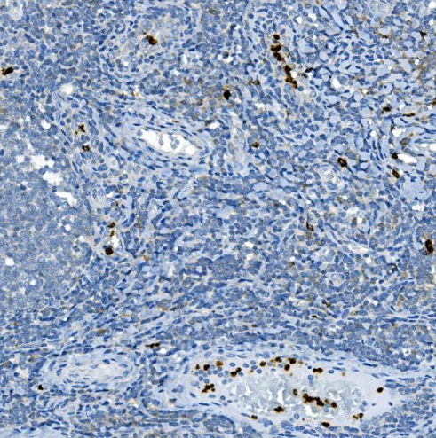 Myeloperoxidase/MPO Rabbit Polyclonal Antibody (APC)