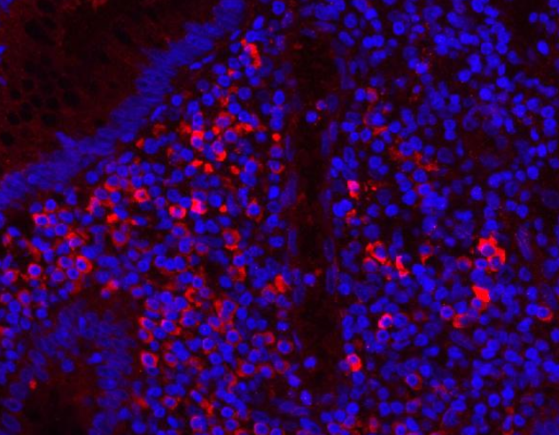 Myeloperoxidase/MPO Rabbit Polyclonal Antibody (APC)