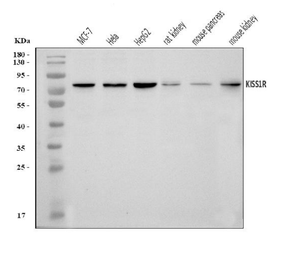 GPR54/KISS1R Rabbit Polyclonal Antibody (PE)