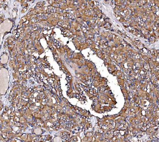 GPR54/KISS1R Rabbit Polyclonal Antibody (PE)