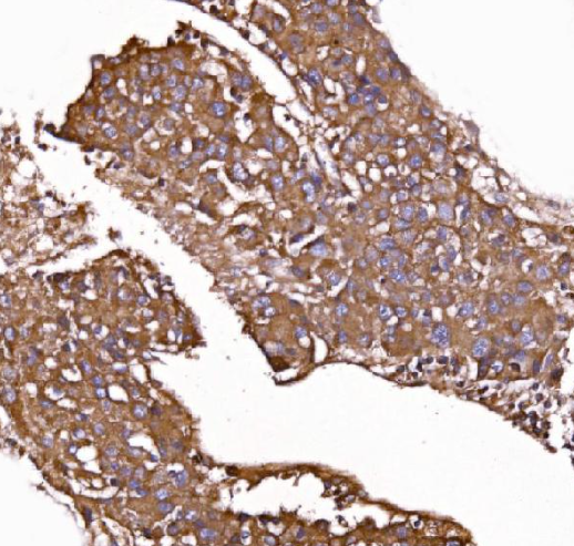 GPR54/KISS1R Rabbit Polyclonal Antibody (PE)