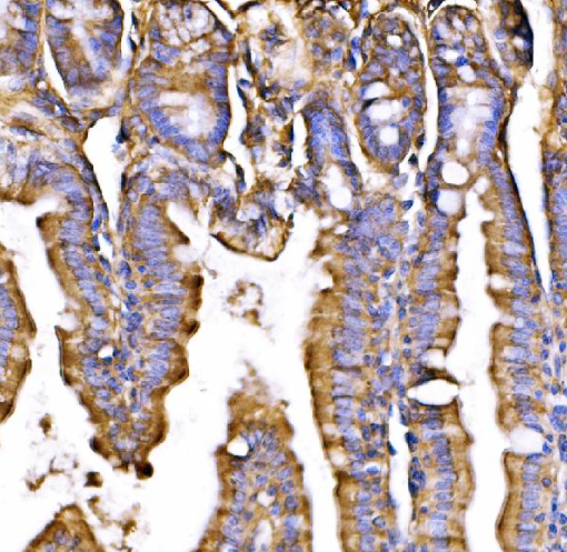 GPR54/KISS1R Rabbit Polyclonal Antibody (PE)