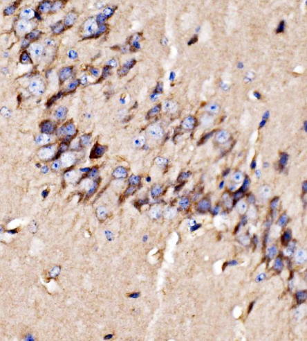 GPR54/KISS1R Rabbit Polyclonal Antibody (PE)