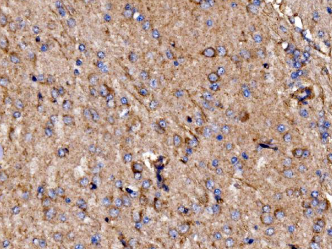GPR54/KISS1R Rabbit Polyclonal Antibody (PE)