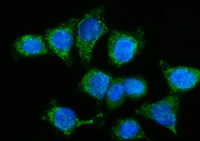 GPR54/KISS1R Rabbit Polyclonal Antibody (PE)