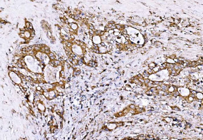GPR54/KISS1R Rabbit Polyclonal Antibody (PE)