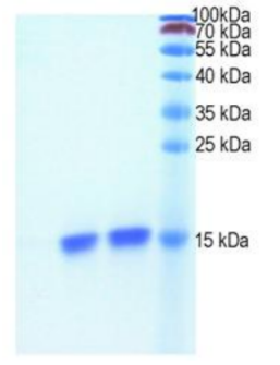 Recombinant Human Basic Fibroblast Growth Factor