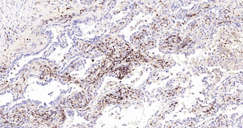 CD45RO Mouse Monoclonal Antibody (8G8)